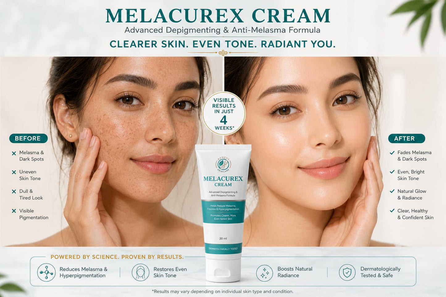 Melacurex Cream – Advanced Depigmenting & Anti-Melasma Formula (30ml)